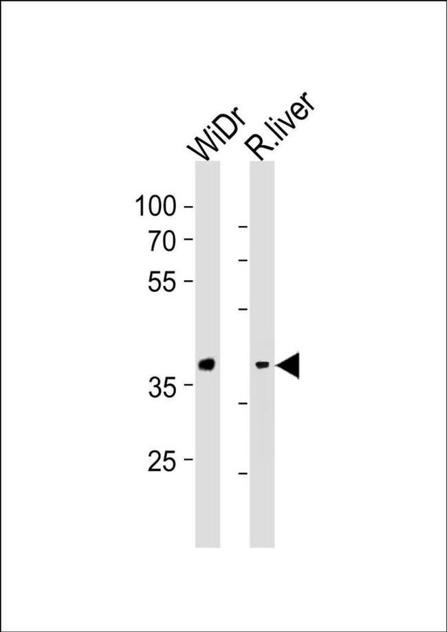 GPR4 Antibody in Western Blot (WB)