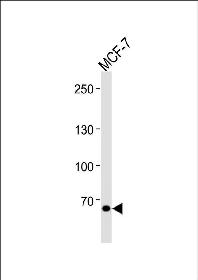 TSPYL2 Antibody in Western Blot (WB)