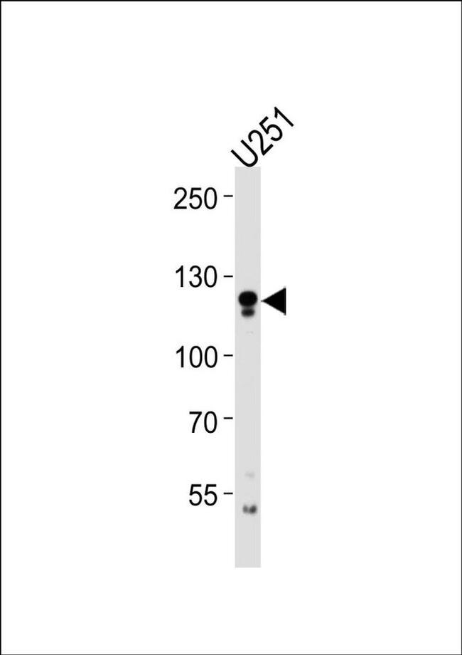 ECE2 Antibody in Western Blot (WB)