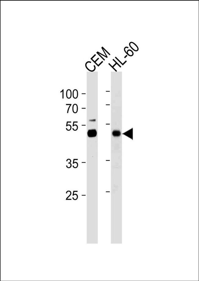 BLMH Antibody in Western Blot (WB)