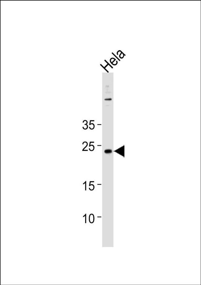 CNO Antibody in Western Blot (WB)
