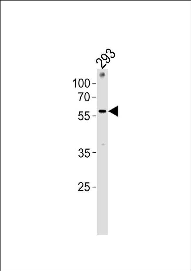 ZNF76 Antibody in Western Blot (WB)
