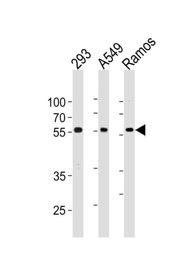 TRIM6 Antibody in Western Blot (WB)