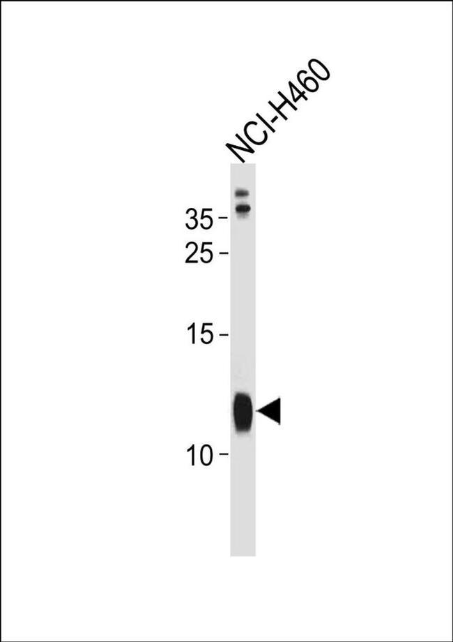 RPS21 Antibody in Western Blot (WB)