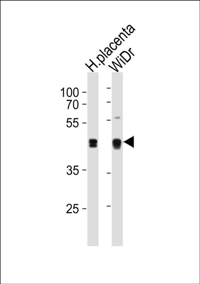 SAP30BP Antibody in Western Blot (WB)