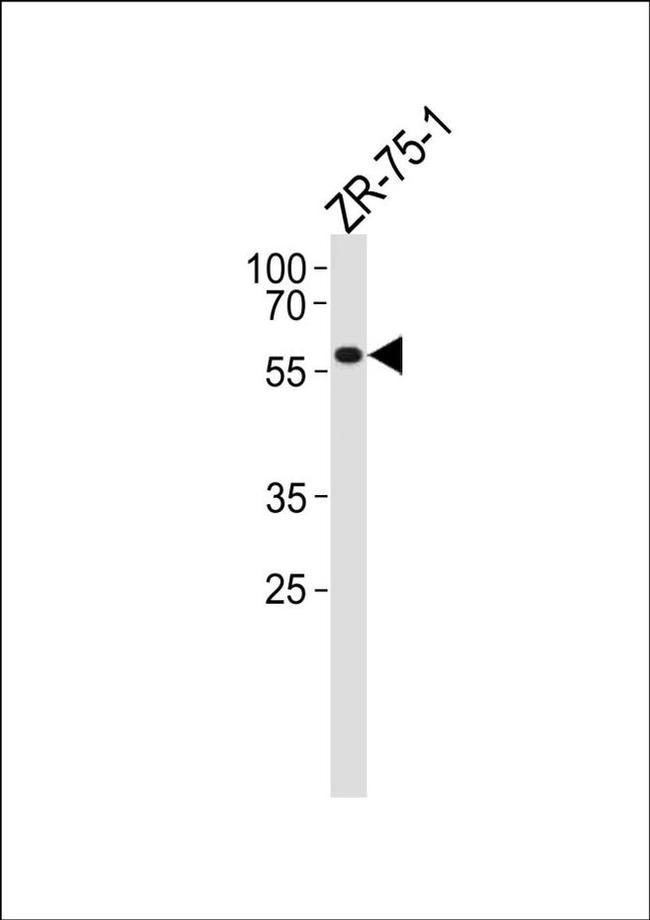 PPP2R2A Antibody in Western Blot (WB)