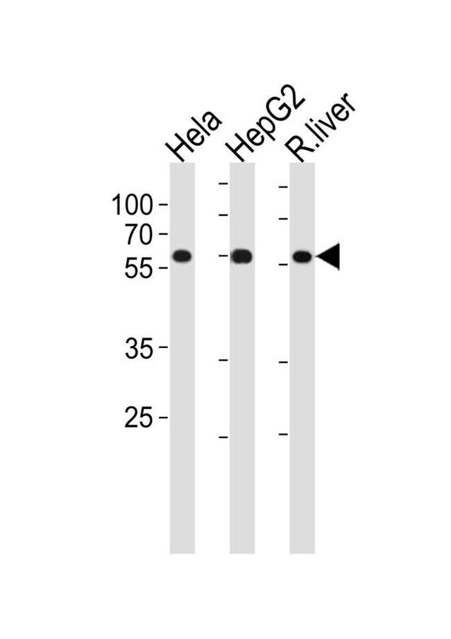 POLD2 Antibody in Western Blot (WB)