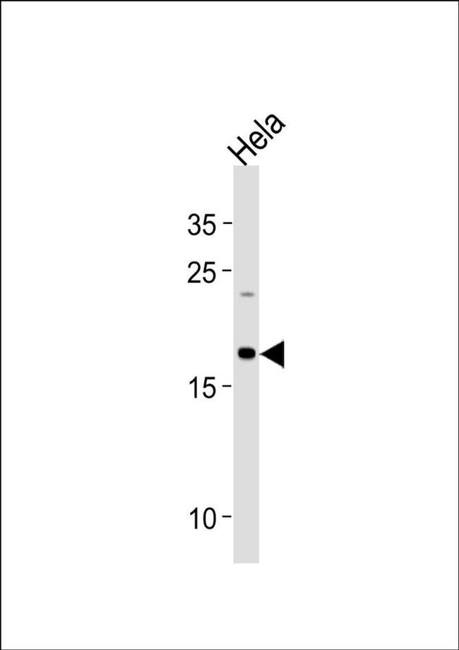 NDUFB10 Antibody in Western Blot (WB)