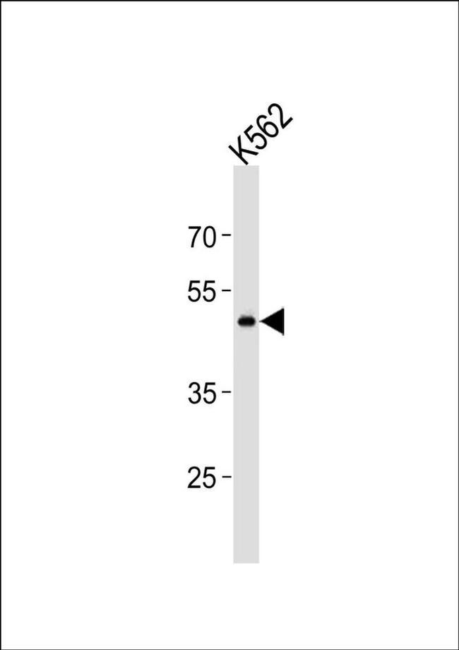 GPR150 Antibody in Western Blot (WB)