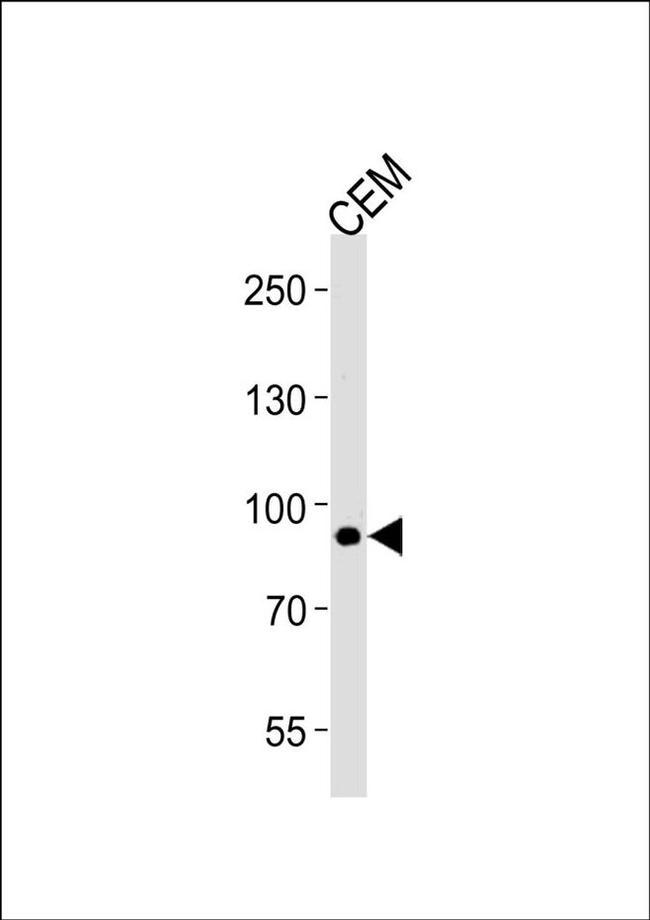 MATN2 Antibody in Western Blot (WB)