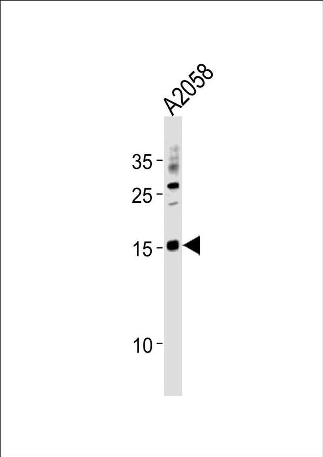 SSNA1 Antibody in Western Blot (WB)