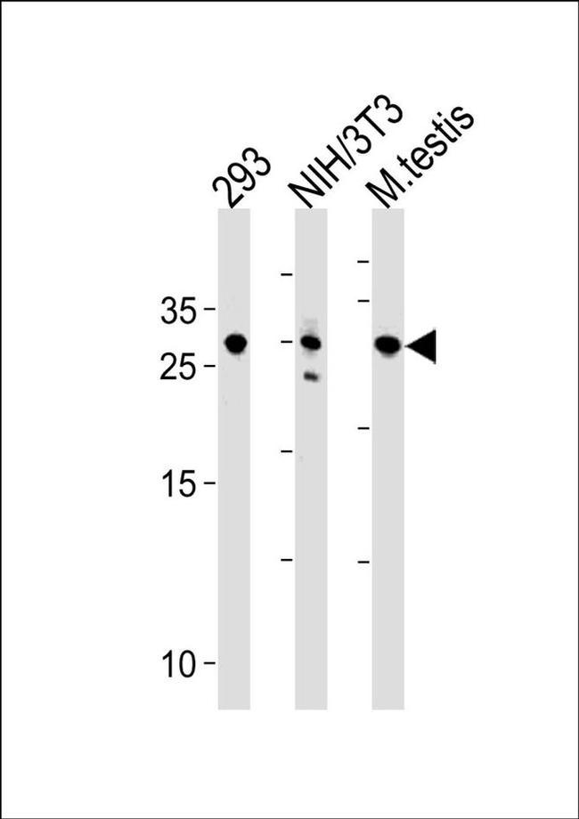 RNF166 Antibody in Western Blot (WB)