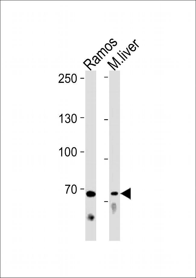 TRIF Antibody in Western Blot (WB)