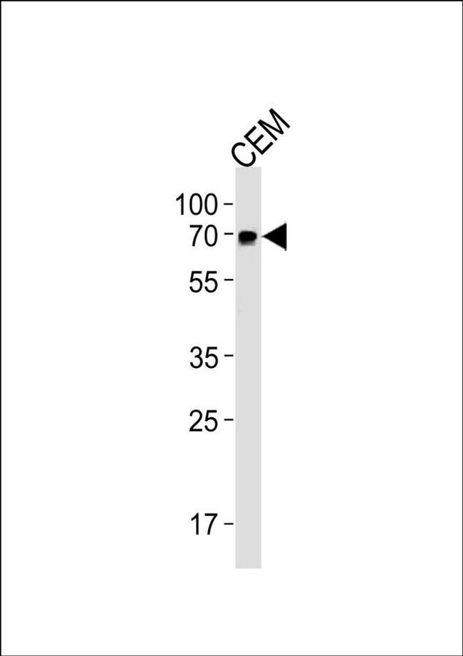 GBP2 Antibody in Western Blot (WB)