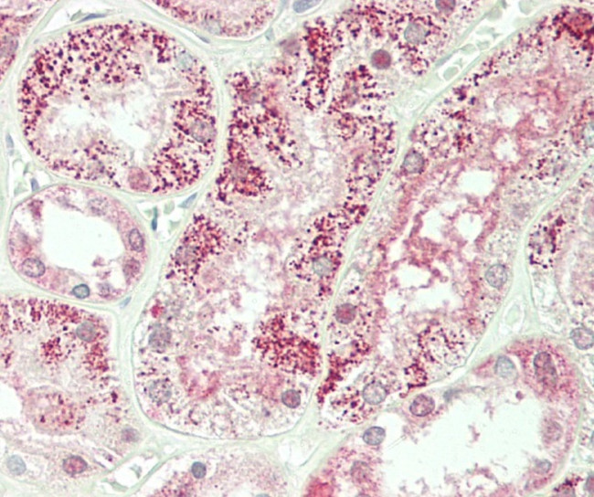 PKP4 Antibody in Immunohistochemistry (Paraffin) (IHC (P))