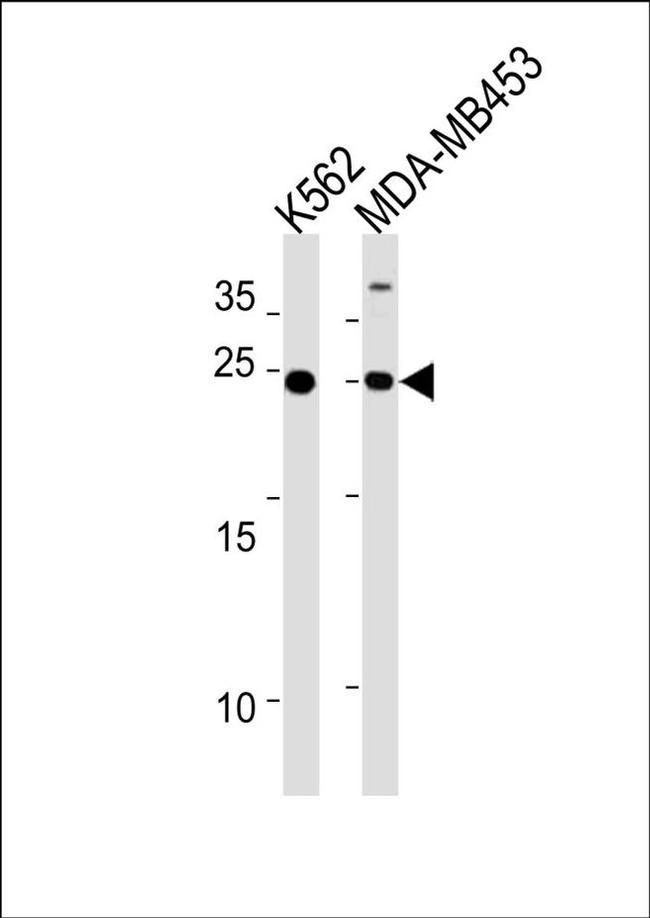 SSPN Antibody in Western Blot (WB)