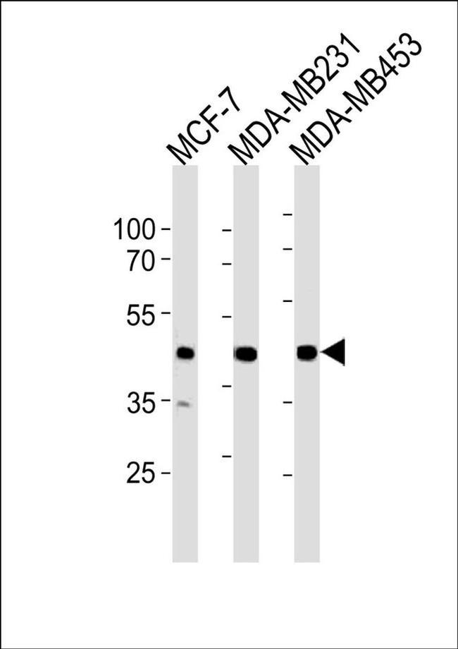 SGCG Antibody in Western Blot (WB)