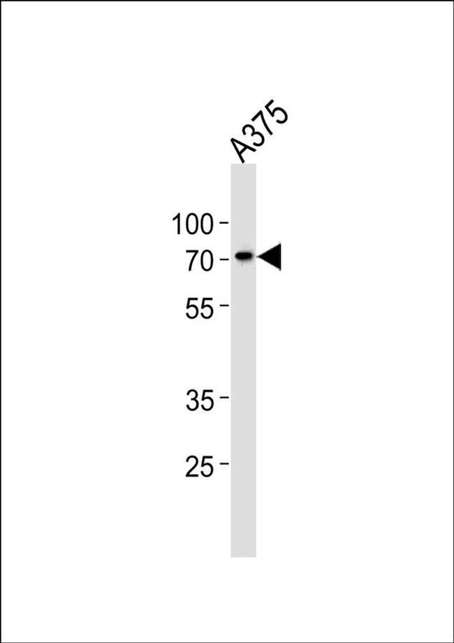 ST7L Antibody in Western Blot (WB)