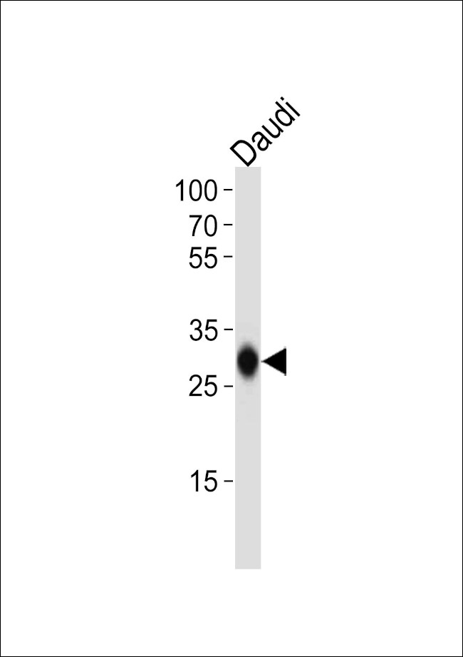 HLA-DQB1 Antibody in Western Blot (WB)