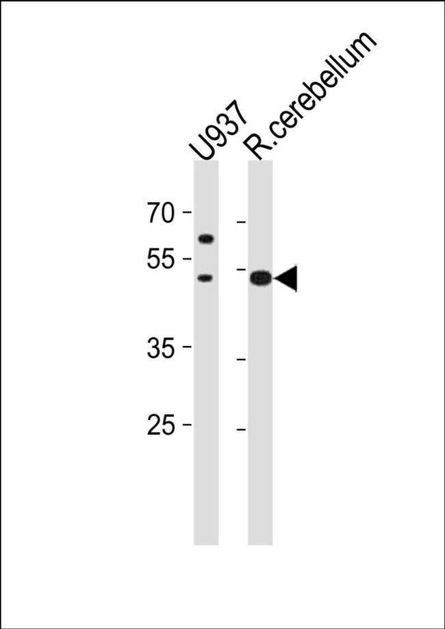 SLC25A25 Antibody in Western Blot (WB)