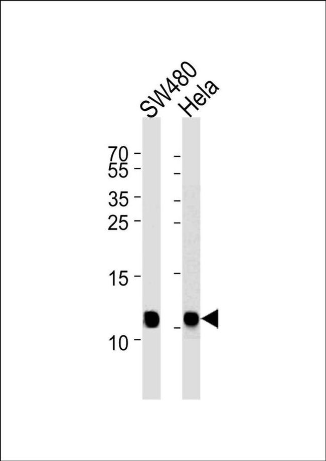 NDUFA4 Antibody in Western Blot (WB)