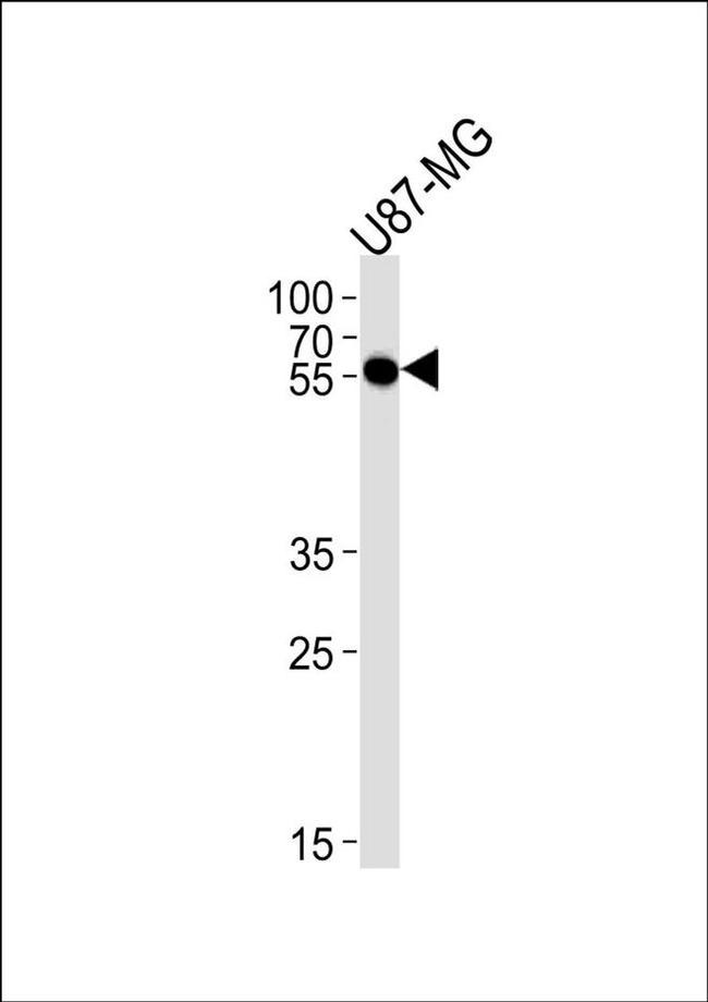 CMAS Antibody in Western Blot (WB)