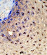PAX3 Antibody in Immunohistochemistry (Paraffin) (IHC (P))