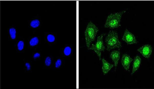 CBF beta Antibody in Immunocytochemistry (ICC/IF)
