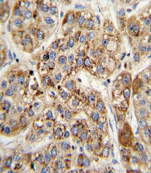 MCCC2 Antibody in Immunohistochemistry (Paraffin) (IHC (P))