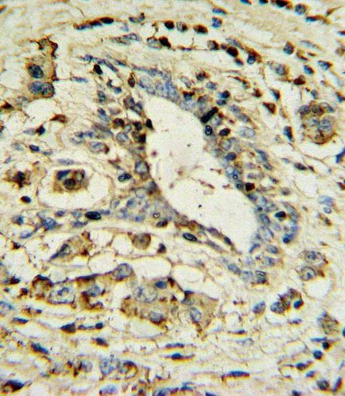 Apolipoprotein L1 Antibody in Immunohistochemistry (Paraffin) (IHC (P))