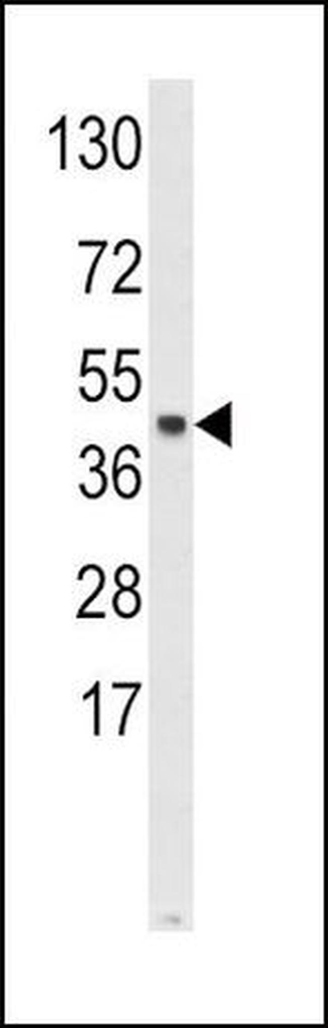 SKP2 Antibody in Western Blot (WB)