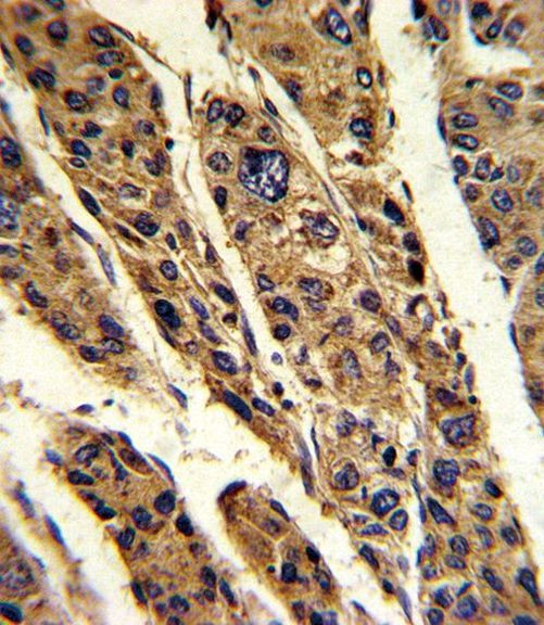 TPT1 Antibody in Immunohistochemistry (Paraffin) (IHC (P))