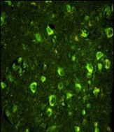 ABI1 Antibody in Immunohistochemistry (Paraffin) (IHC (P))