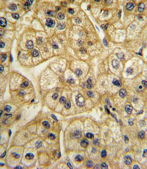 AP2A2 Antibody in Immunohistochemistry (Paraffin) (IHC (P))
