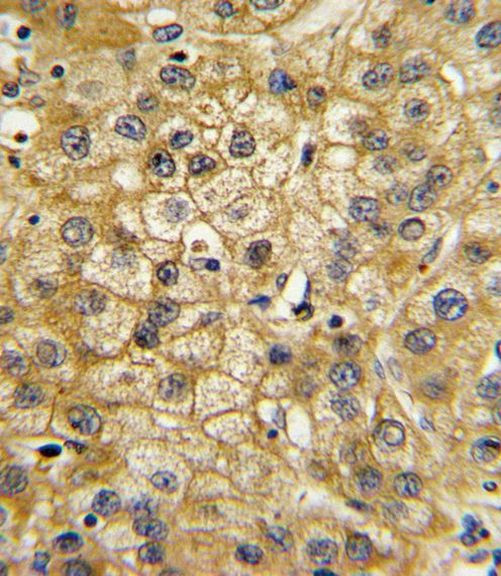 Adiponectin Receptor 1 Antibody in Immunohistochemistry (Paraffin) (IHC (P))