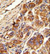 KLC1 Antibody in Immunohistochemistry (Paraffin) (IHC (P))