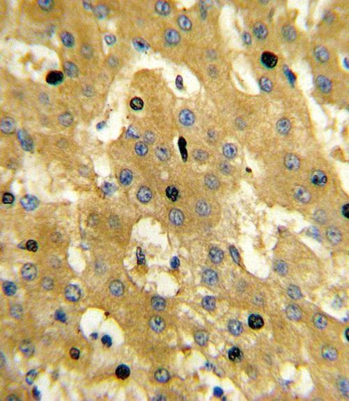 SCP2 Antibody in Immunohistochemistry (Paraffin) (IHC (P))