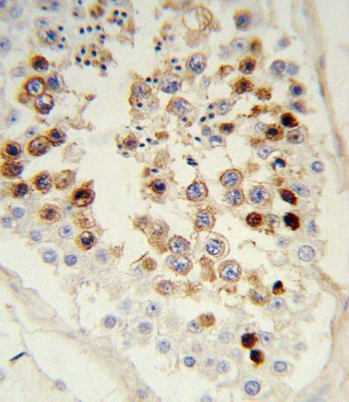 SNAIL Antibody in Immunohistochemistry (Paraffin) (IHC (P))