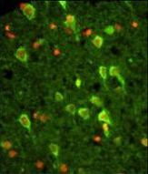 Annexin A7 Antibody in Immunohistochemistry (Paraffin) (IHC (P))