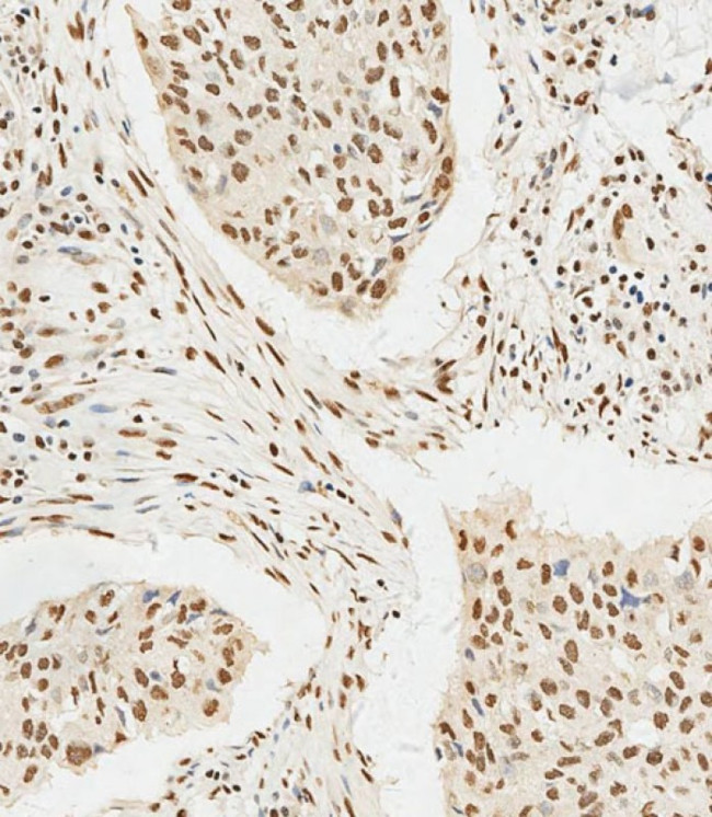 HSPA7 Antibody in Immunohistochemistry (Paraffin) (IHC (P))