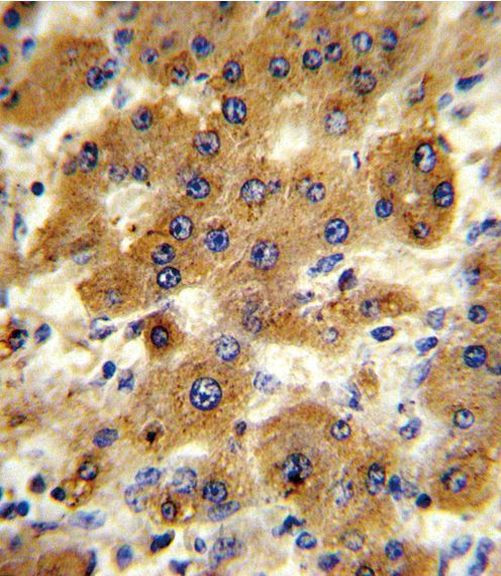 CYP8B1 Antibody in Immunohistochemistry (Paraffin) (IHC (P))