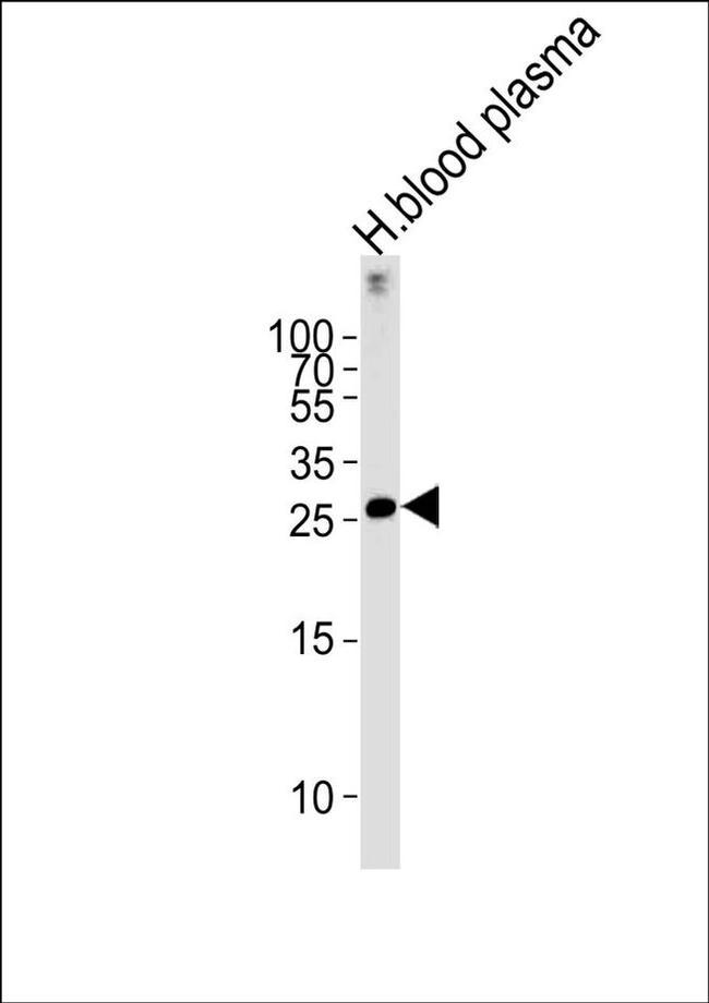 C1QB Antibody in Western Blot (WB)