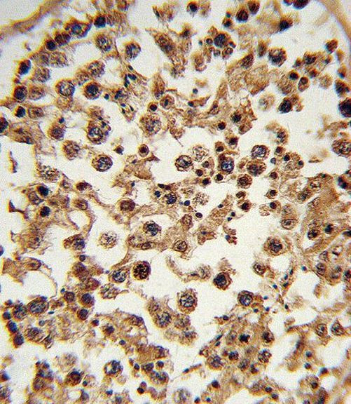 ETV6 Antibody in Immunohistochemistry (Paraffin) (IHC (P))