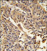 gamma Catenin Antibody in Immunohistochemistry (Paraffin) (IHC (P))