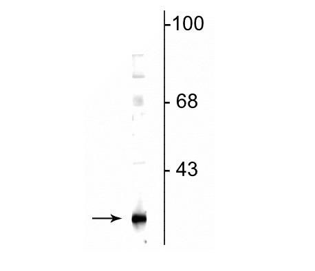 GSTK1 Antibody in Western Blot (WB)