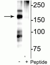 Phospho-NMDAR2B (Ser1166) Antibody in Western Blot (WB)