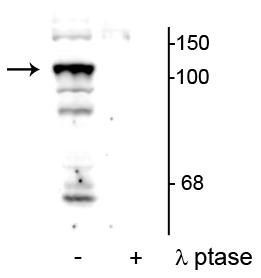 Phospho-PTPN3 (Ser459) Antibody in Western Blot (WB)