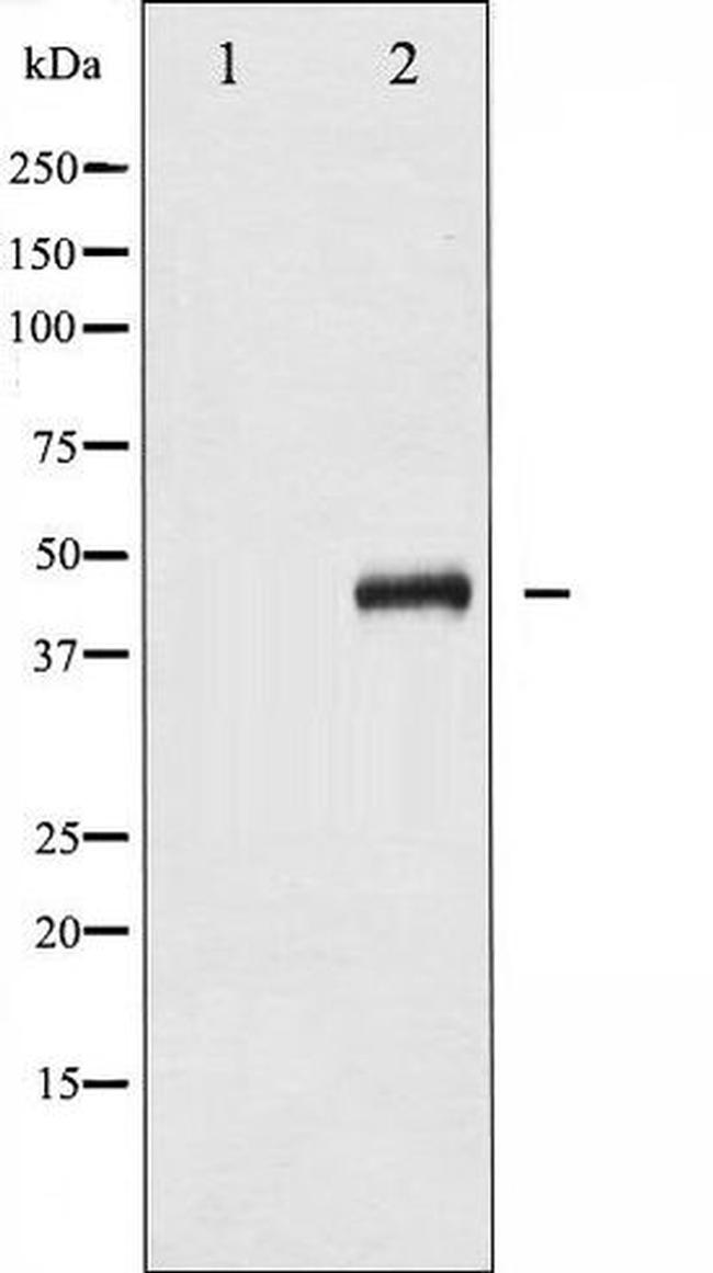 Phospho-MAP2K4 (Ser80) Antibody in Western Blot (WB)