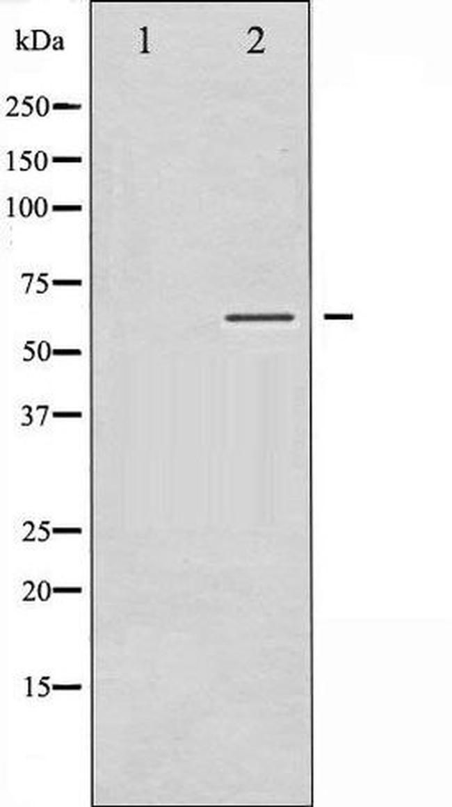 Phospho-SGK (Ser422) Antibody in Western Blot (WB)