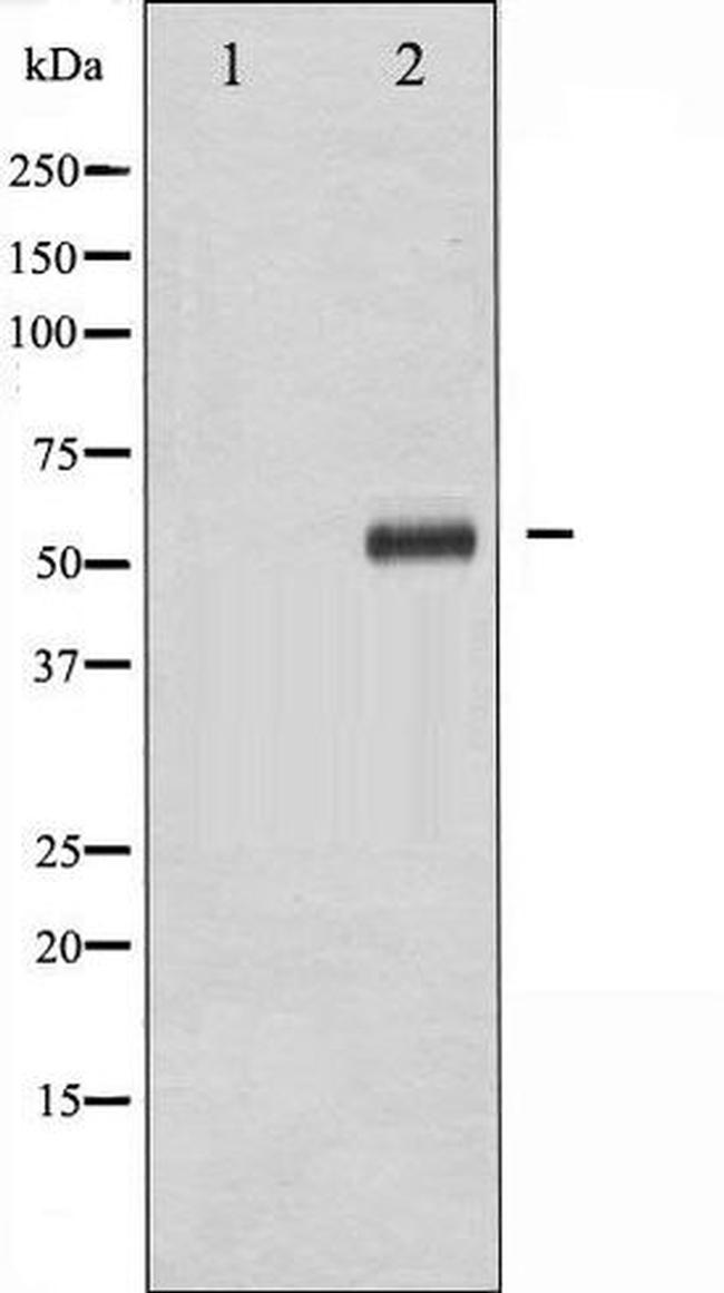 Phospho-DOK2 (Tyr299) Antibody in Western Blot (WB)